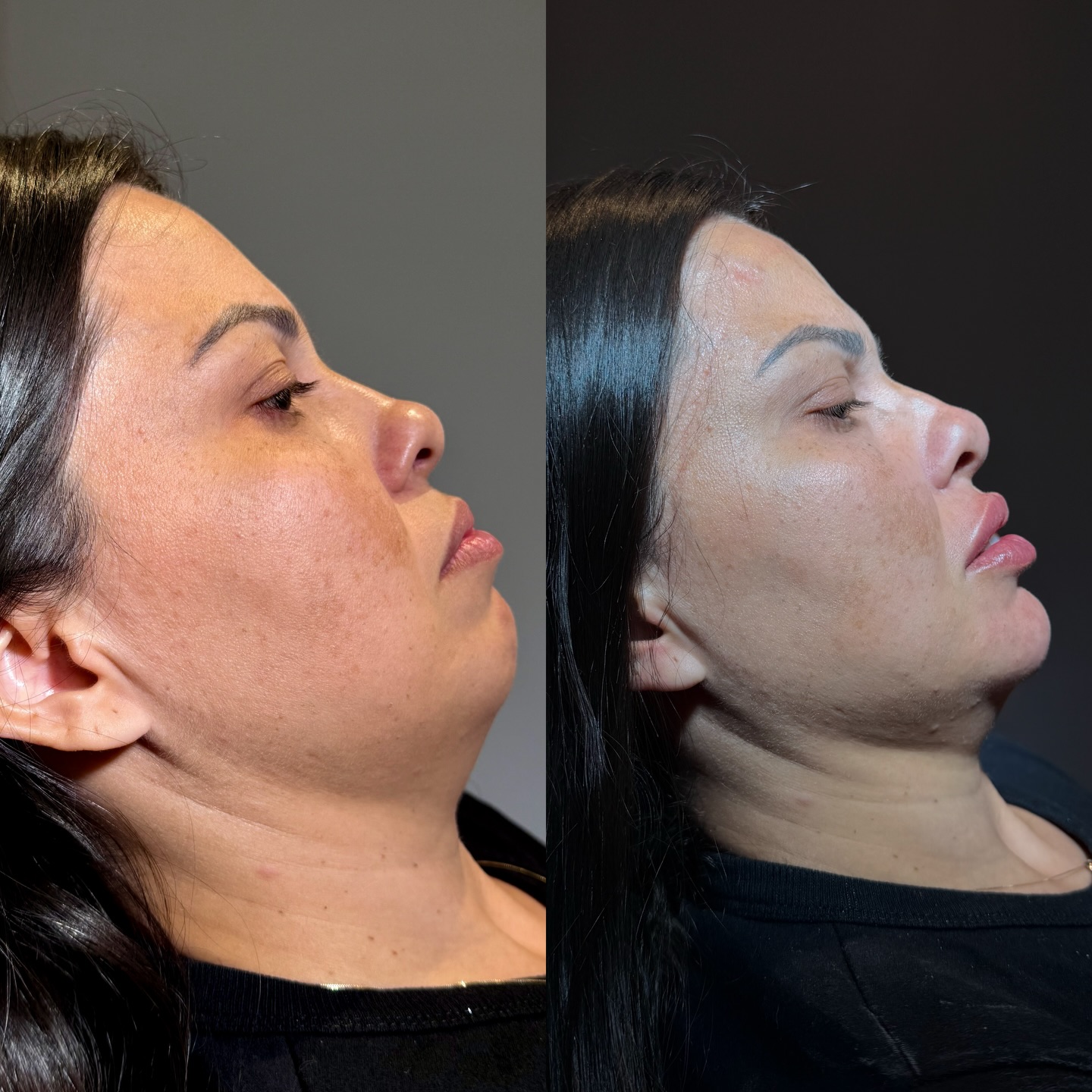 Publicação do perfil da Dra. Karísia Sirotto no Instagram