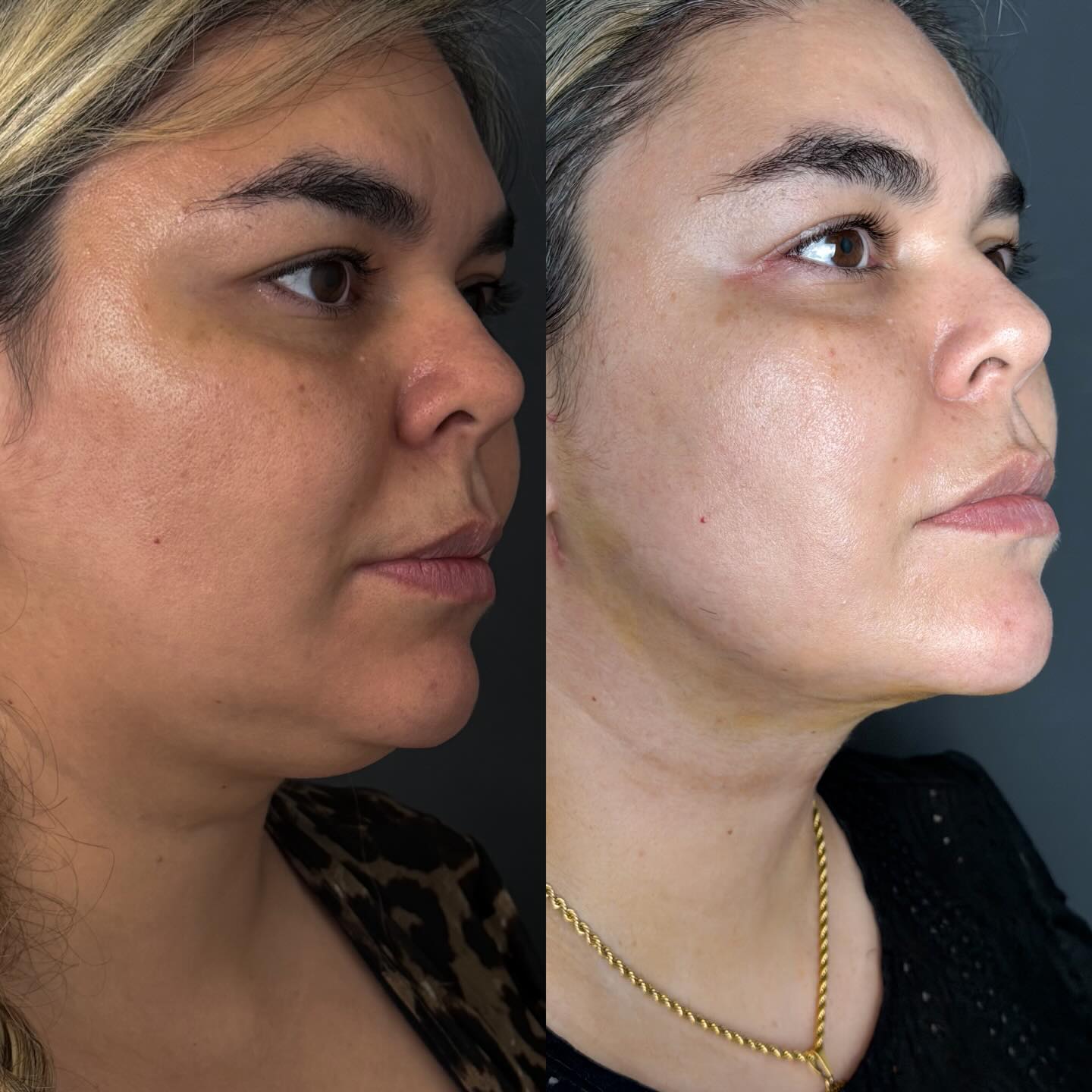 Publicação do perfil da Dra. Karísia Sirotto no Instagram