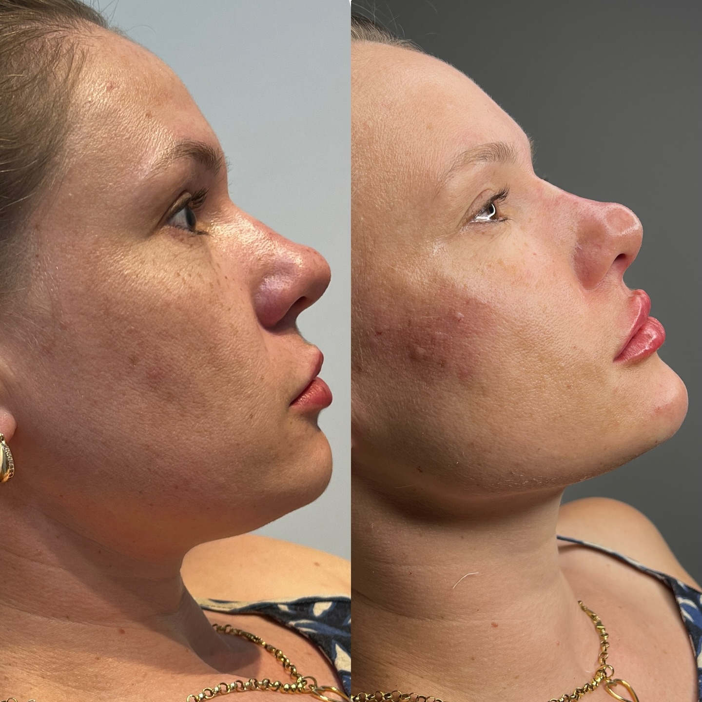 Publicação do perfil da Dra. Karísia Sirotto no Instagram